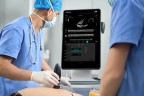УЗ сканер Mindray ТЕ Air i3P